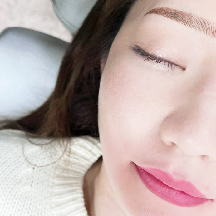 BROW（眉）への施術の一例 4D